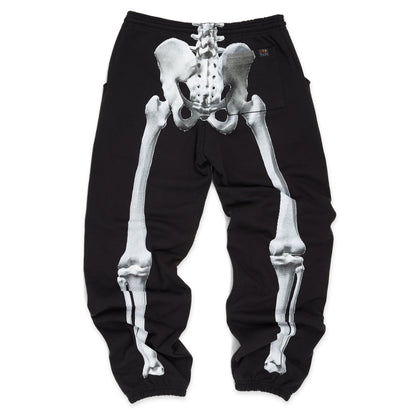 SkeleSweat Pants
